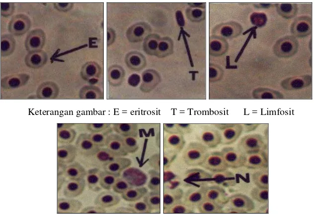Gambar 3. Susunan darah ikan (Chinabut and Limsuwan, 1991) 