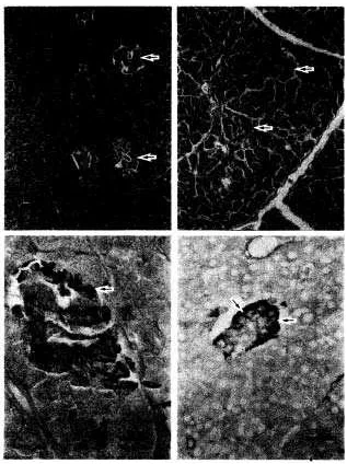 Gambar 1. ( Fotomikrograf pankreas kambing (A,C) dan domba (B,D). Pankreas domba (B) mempunyai lobulasi yang lebih jelas daripada pankreas kambing (A), ditandai dengan septa interlobular yang lebih nyata