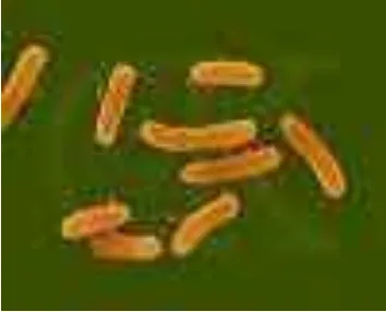 Gambar 3.  Salmonella typhimurium  Sumber:  Fox (2000) 