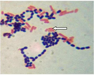 Gambar 4.  Escherichia coli 