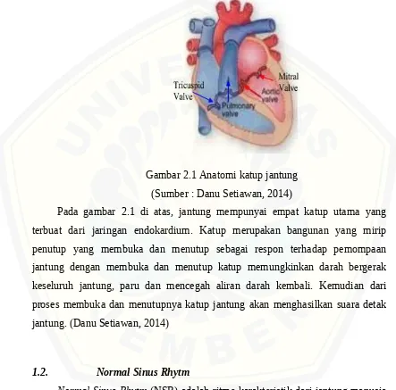 Gambar 2.1 Anatomi katup jantung