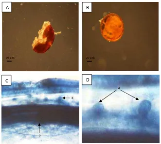 Gambar 1.Spora Genus Glomus dan Struktur Mikoriza Arbuskula pada Alangalang. (A) Glomus tipe 1, (B) Glomus tipe 2, (C) Struktur Mikoriza