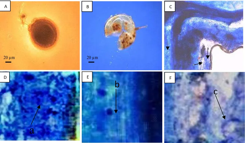 Gambar 2. Spora dan Struktur Mikoriza Arbuskula pada Rumput Bahia.(A) Acaulospora, (B) Gigaspora tipe 1, (C) Struktur Mikoriza Arbuskula(a
