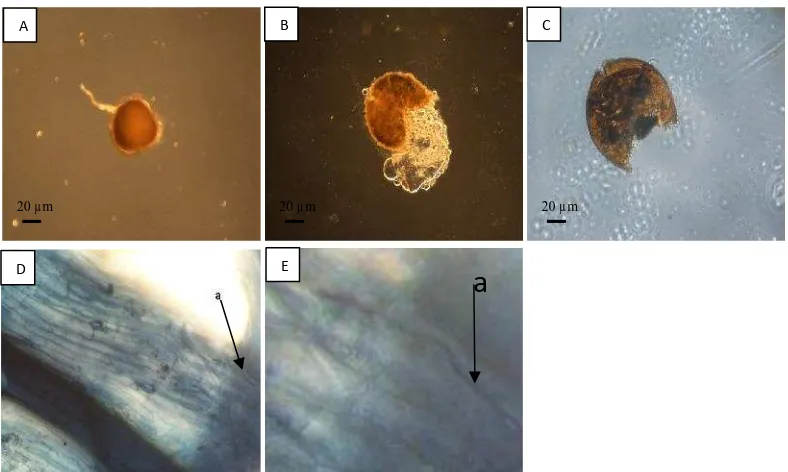 Gambar 4.   Spora dan Struktur Mikoriza Arbuskula pada Teki. (A) Gigaspora tipe 2,(B) Glomus tipe 6, (C) Glomus tipe 7, (D) Struktur Mikoriza Arbuskula(a