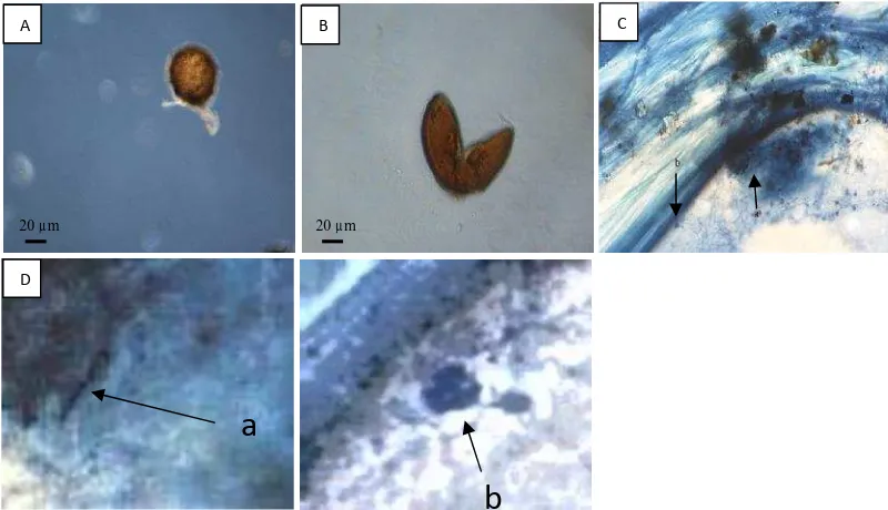 Gambar 5.   Spora Genus Glomus dan Struktur Mikoriza Arbuskula pada Kakao.(A)Glomus tipe 8, (B) Glomus tipe 9, (C) Struktur Mikoriza Arbuskula (a.Hifa, b