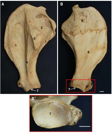 Gambar 7 Morfologi os scapula kiri badak Sumatera tampak lateral (A) dan medial (B)  Inset: angulus ventralis dari os scapula kanan (B1)   1