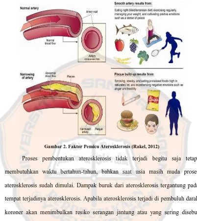Gambar 2. Faktor Pemicu Aterosklerosis (Rakel, 2012) 