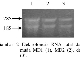 Gambar 2 Elektroforesis RNA total dari daun 
