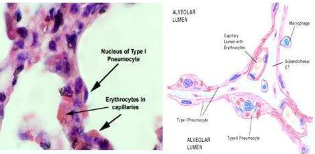 Gambar 1.2. Struktur alveoli dengan komponen penyusunnya berupa : pneumosit tipe I (bersifat membranous), pneumosit tipe II (bersifat granular ) serta sel makrofag alveolar