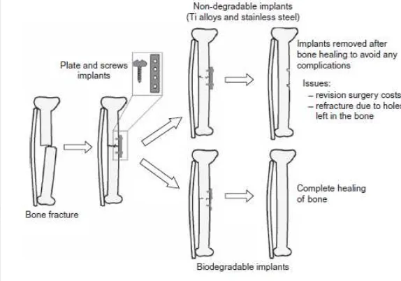 Gambar 1 Skema proses penyembuhan tulang dengan menggunakan implan 