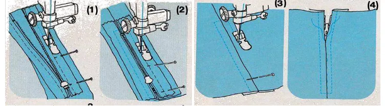 Gambar 2.28 Teknik Pemasangan Tutup Tarik Simetris  Sumber : Graef, Judy Lynn (1976:hlm