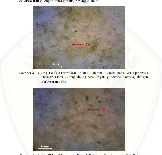 Gambar 4.14 (n) Tidak Ditemukan Kristal Kalsium Oksalat pada Sel Epidermis Helaian Daun (tengah daun) Sawi hijau (Brassica yuncea) dengan Perbesaran 417x 