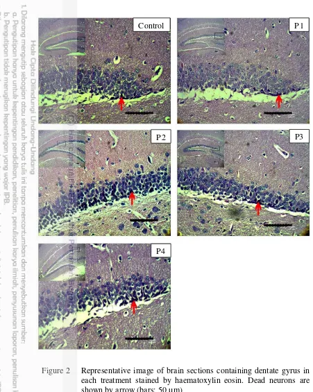 Figure 2 Representative image of brain sections containing dentate gyrus in 