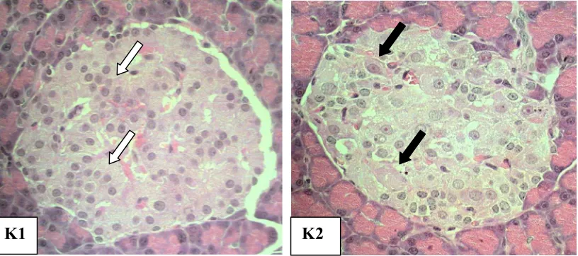 Gambar 4 Gambaran histopatologi pankreas.  