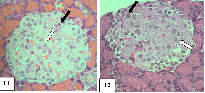 Gambar 5 Gambaran histopatologi pankreas. 
