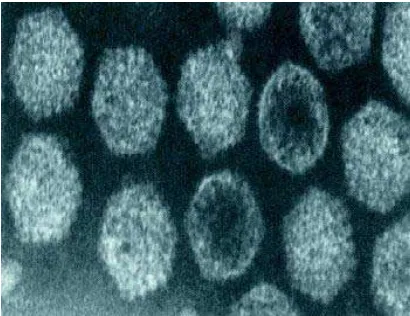 Gambar 1 Partikel virus IBD (Baxendale & Wit 2000) 