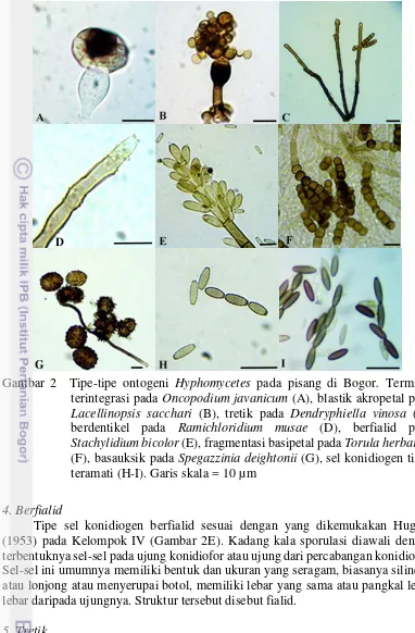 Gambar 2  Tipe-tipe ontogeni Hyphomycetes pada pisang di Bogor. Terminal 