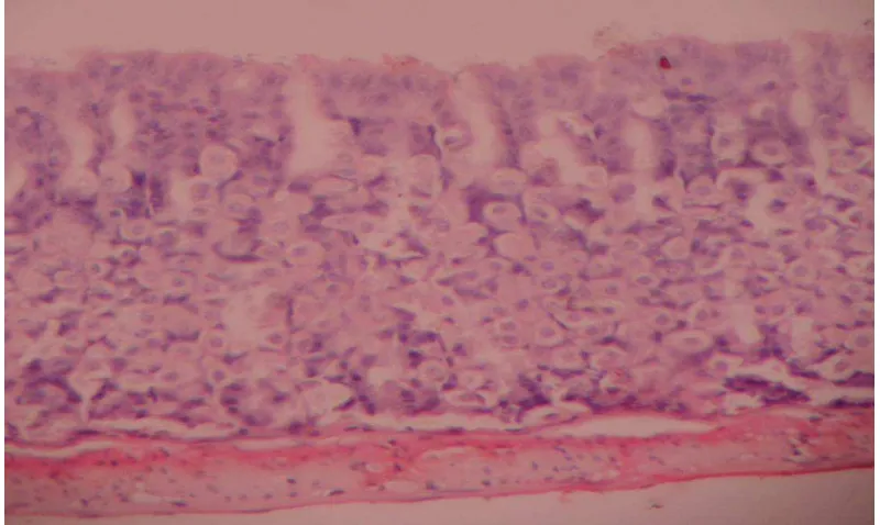 Gambar Mikroskopik Erosi Mukosa/Ulkus Gaster Mencit 