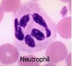 Gambar 4. Sel Neutrofil (diaglab.vet.cornell.edu 2008) 