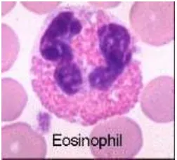 Gambar 5. Sel Eosinofil (diaglab.vet.cornell.edu 2008) 