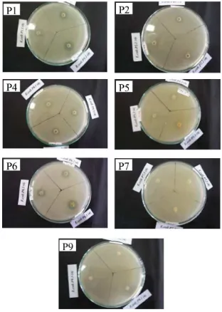 Gambar 4.  Diameter Zona Penghambatan Isolat Bakteri Rizosfer RumputPangola terhadap Bakteri E
