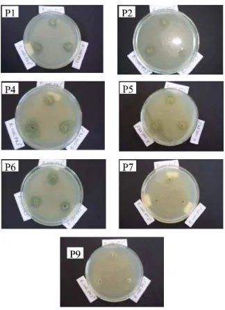 Gambar 5. Diameter Zona Penghambatan Isolat Bakteri Rizosfer RumputPangola terhadap Bakteri E