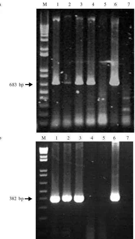 Figure 2. RT-PCR detection of Bean common mosaic virus with CIRevand CIFor primers (a); and Cucumber mosaic virus CMV 1Fand CMV 1R (b)