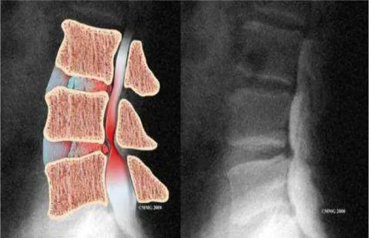 Gambar 5. Hasil foto spinal cord