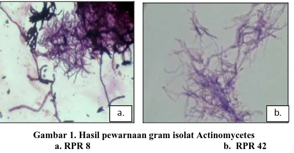 Gambar 1. Hasil pewarnaan gram isolat Actinomycetes a. RPR 8    b.  RPR 42