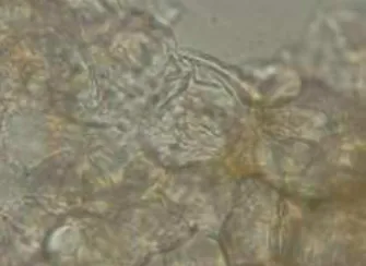 Gambar 4 . sel jaringan daun  ( Perbesaran 400×) . 