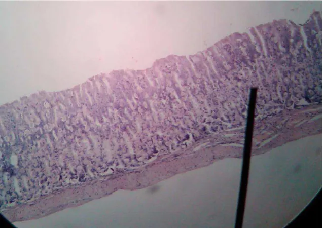 Gambar Mikroskopis Erosi Mukosa Gaster Mencit 