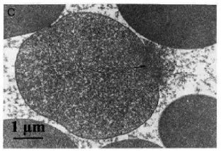 Gambar 4. Kerusakan membran sel darah merah yang menyebabkan hemolisis  (Niki, et al. 1988)