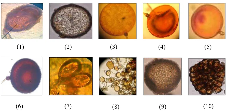 Figure 1:         (1. Morphological character of AMF spore under light microscopes (400 X magnification);   Acaulospora foveata; 2 Acaulospora