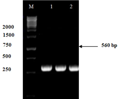 Figure 2. Microscopic characteristics of Fusarium sp. isolate w1 (A) macro conidia (B) septated hypae (C) Chlamydospore