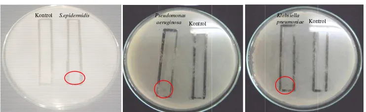 Gambar 3. HGeepidermidis (AHasil uji bioaA), Pseudomonutografi ekstrnas aeruginosarak daun tuma (B), dan Klebmbuhan sala bsiella pneumoterhadap Staoniae (C) aphylococcus 