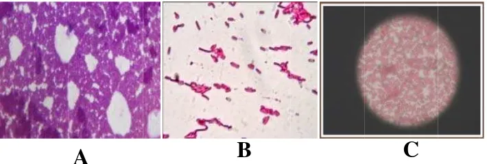 Gambar 1. HGaaeruginosa (BHasil pengecatB), dan Klebsietan Gram baella pneumoniaakteri Staphyloae (C) ococcus epideermidis (A), Pseudomonas P