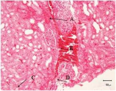 Gambar 3. Gambaran mikroskopis ginjalmencit pada pemberianpegagan 250 mg/kg bb (HE,400x) A