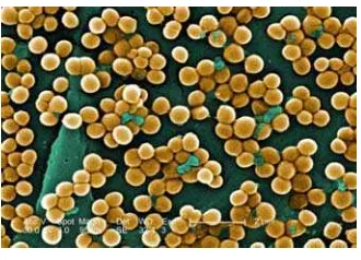 Gambar 6  Bakteri Staphylococcus aureus.  