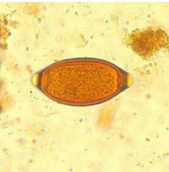 Gambar 4. Telur trichuris trichiura (CDC, 2013).