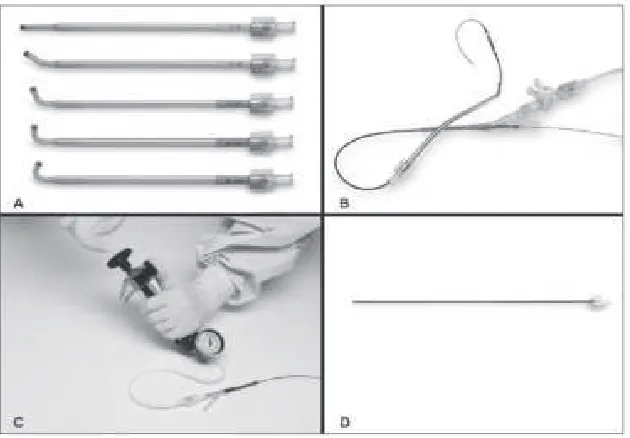 Gambar 1. Peralatan balloon catheter dilation.5