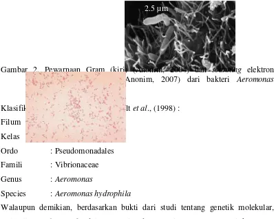 Gambar 2. Pewarnaan Gram (kiri) (Anonim, 2004) dan scanning elektron 