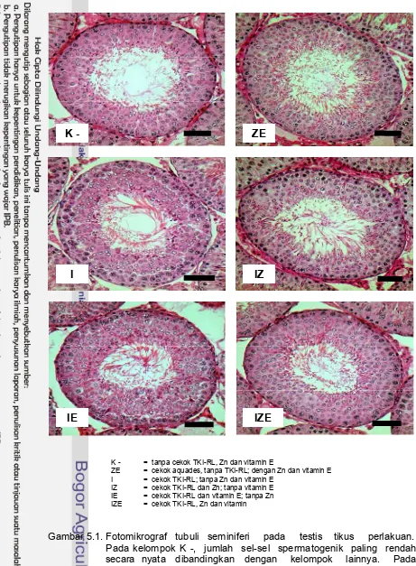 Gambar 5.1. Fotomikrograf   tubuli   seminiferi     pada     testis    tikus     perlakuan