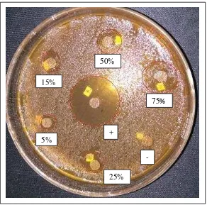 Gambar 6. Diameter zona inhibisi ekstrak n-heksan daun J. curcas