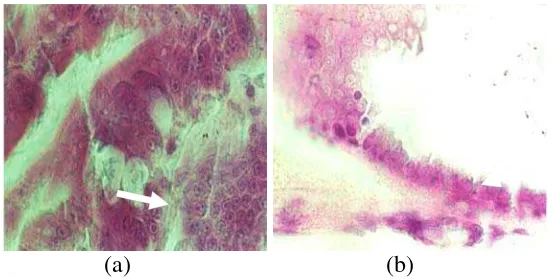 Gambar 5. Eosinofilik Hipertropi dan Inclusion BodiesTerserang Virus WSSV (a), dan Basofilik Hipertropi serta  Sel-Sel Benur YangOcclusion BodiesBenur Yang Terserang MBV (b)