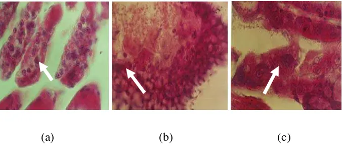Gambar 1. Eosinofilik Hipertropi dan Occlusion Bodies Sel-Sel Insang(a), Hepatopankreas (b), Usus (c) Udang yang Terserang MBV.