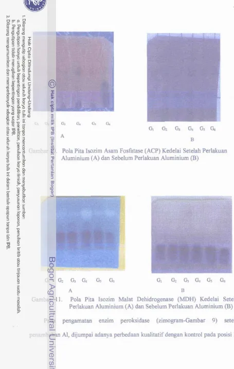 Gambar 10. Pola Pita Isozim Asam Fosfatase (ACP) Kedelai Setelah Perlalaan 
