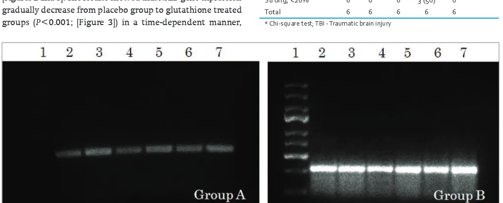 Figure 1: RT‑PCR results of the 341 base pair (bp) fragment represents expression of NR2B gene expression