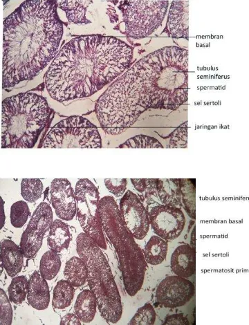 Gambar 10 .  Histologi     organ    testis                       kelompok kontrol (atas),                        dan kelompok uji  (bawah) 