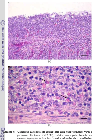 Gambar 6.  Gambaran histopatologi insang dari ikan yang terinfeksi virus pada perlakuan Tii (suhu 25±2 oC); infeksi virus pada lamella insang memicu hyperplasia dan fusi lamella sekunder dari lamella-lamella yang berdekatan pada hampir semua bagian insang sehingga hampir menghilangkan struktur lamella insang, bar = 14.9 µm (a); badan inklusi virus terlihat jelas menyebar hampir merata diantara lamella sekunder, anak panah, bar = 5.6 µm (b) 