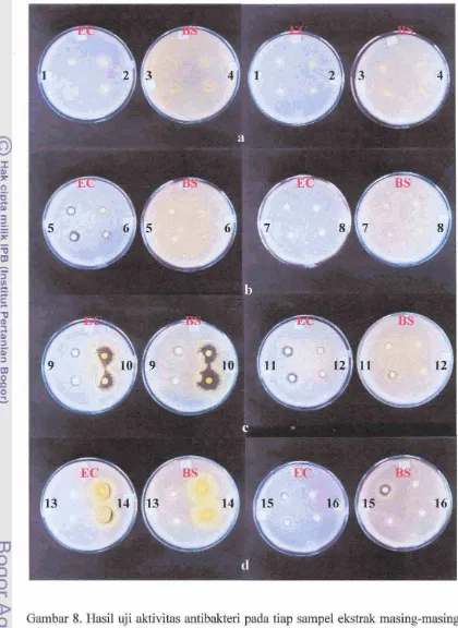 Gambar 8. Hasil uji aktivitas antibakteri pada tiap sampel ekstrak masing-masing 